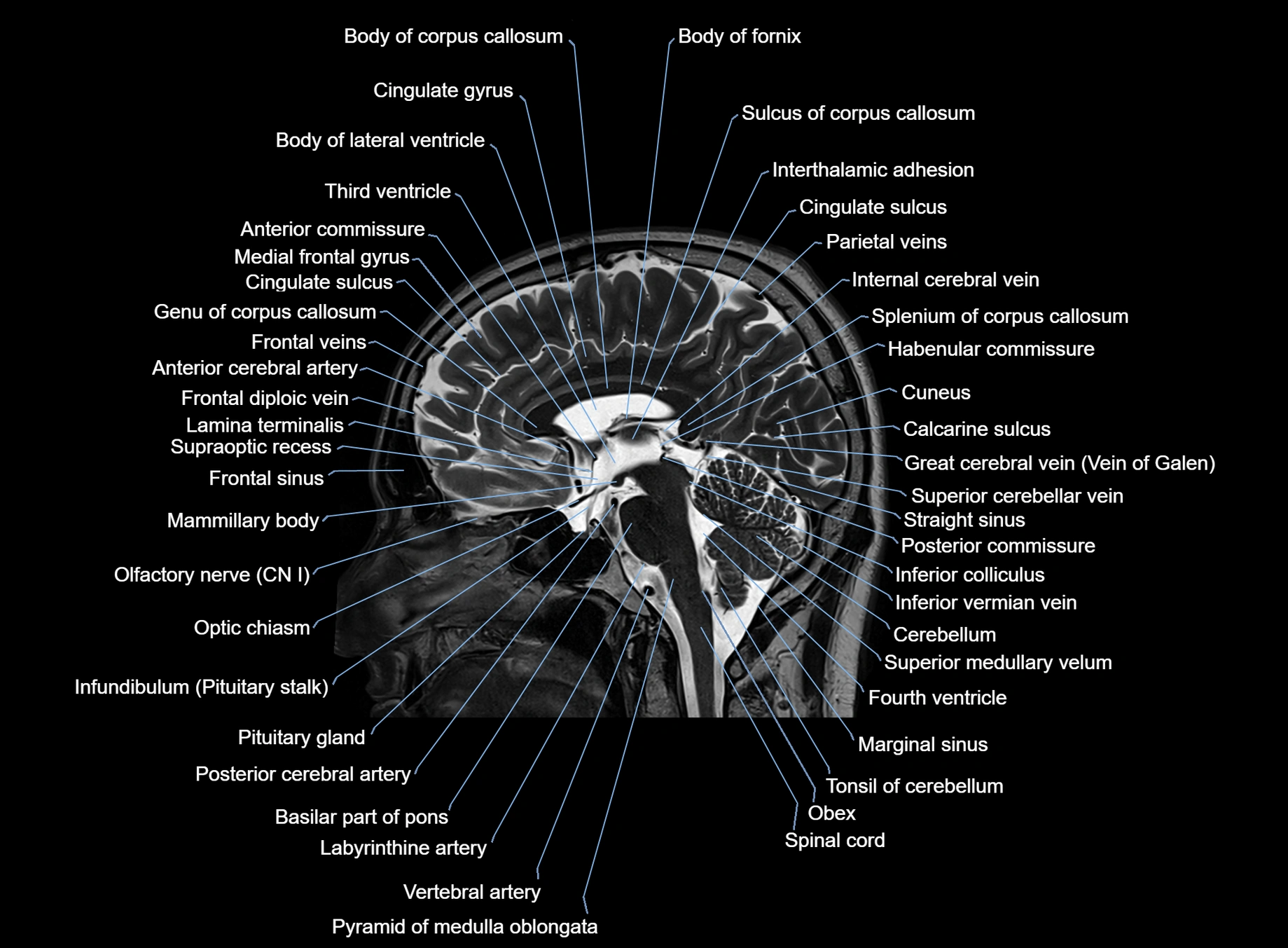 brain sagittal anatomy 3T MRI images -img-00001-00035.webp